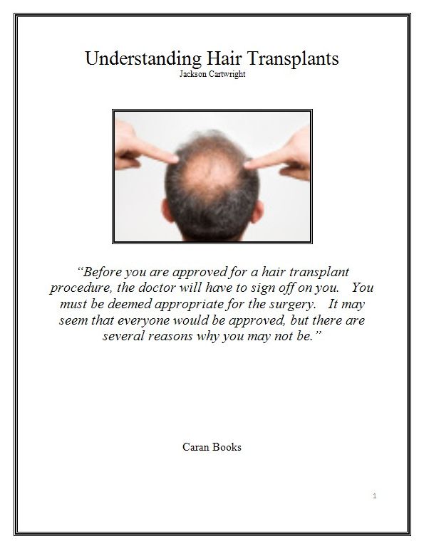 Understanding Hair Transplants