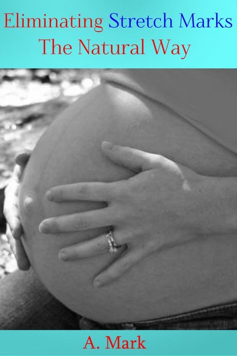 Eliminating Stretch Marks The Natural Way