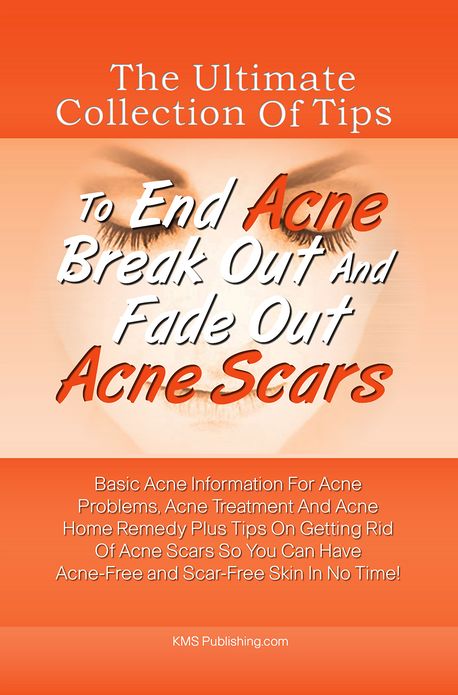 The Ultimate Collection Of Tips To End Acne Break Out And Fade Out Acne Scars: Basic Acne Information For Acne Problems, Acne Treatment And Acne Home Remedy Plus Tips On Getting Rid Of Acne Scars So You Can Have Acne-Free and Scar-Free Skin In No Time!