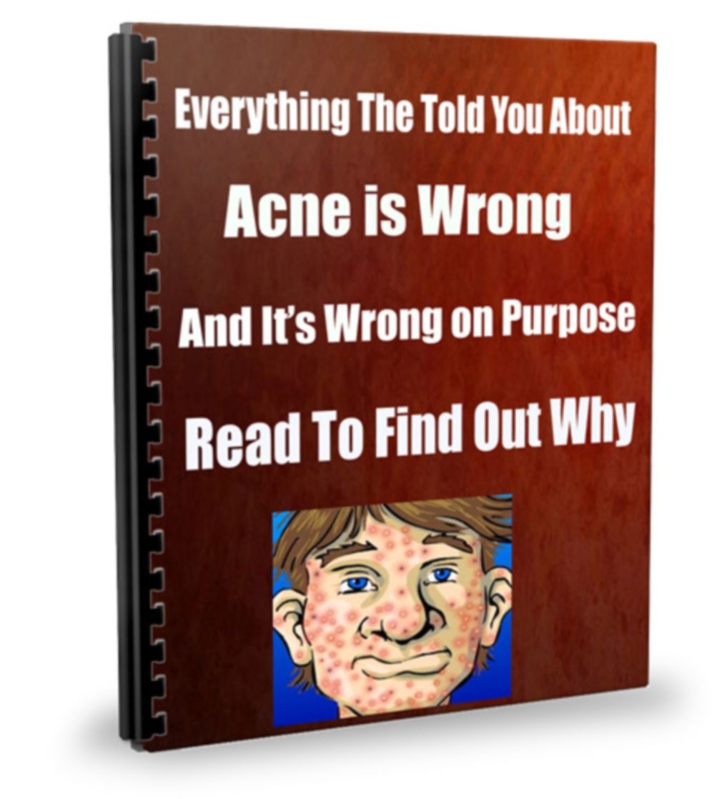 Everything The Told You About Acne is Wrong-And its Wrong on Purpose-They Dont Want You To Learn-Read To Find Out Why.