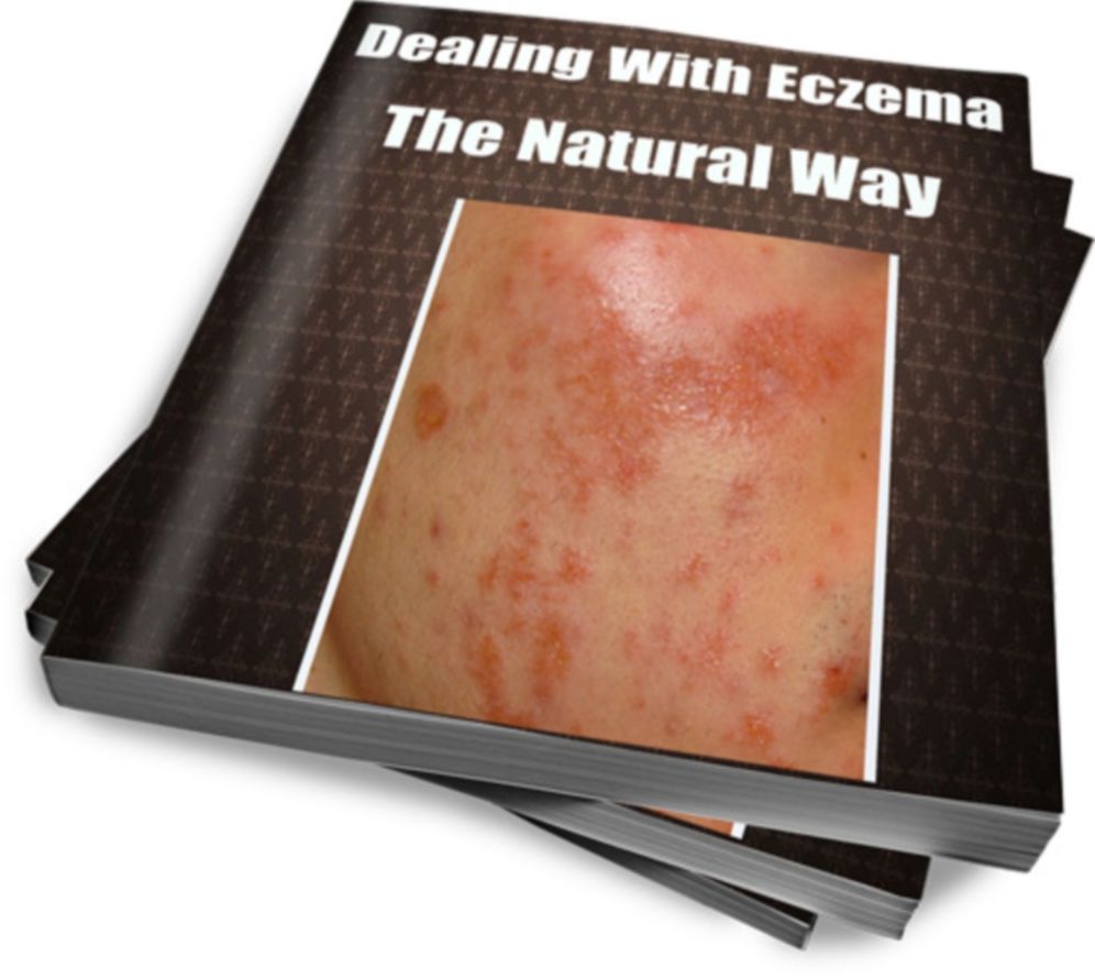 Dealing With Eczema The Natural Way