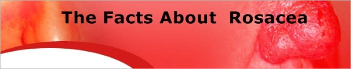 Common Questions About Roeeita