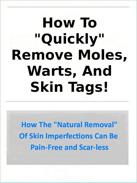 How To Quickly Remove Moles, Warts, and Skin Tags;How The "Natural Removal Of Skin Imperfections Can Be Pain-Free And Scar-Less