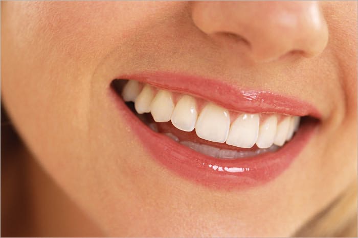 Teeth Whitening - From Yellow to Ivory White