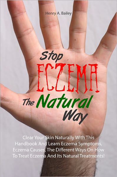 Stop Eczema The Natural Way: Clear Your Skin Naturally With This Handbook And Learn Eczema Symptoms, Eczema Causes, The Different Ways On How To Treat Eczema And Its Natural Treatments!
