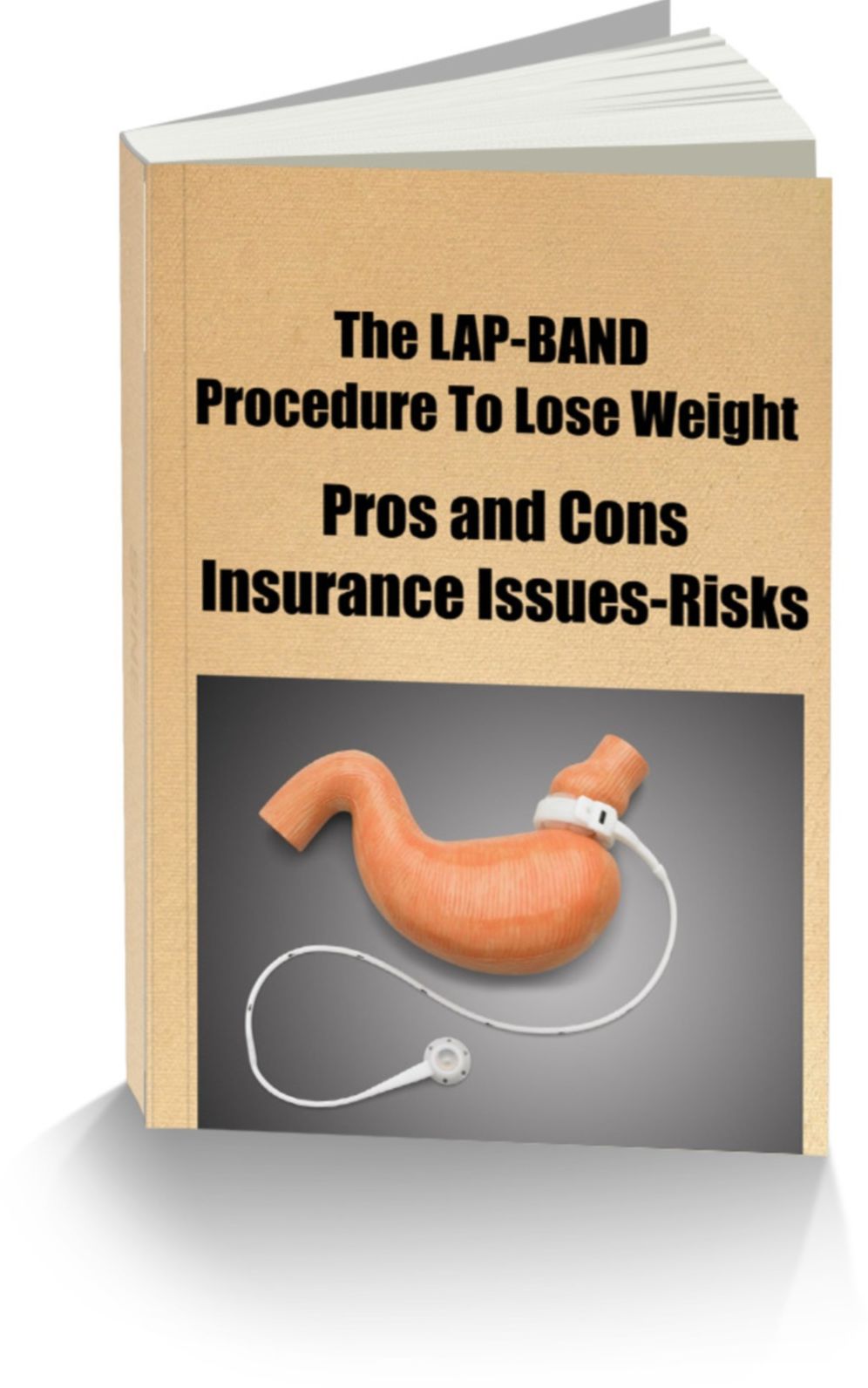 The LAP-BAND Procedure To Lose Weight Pros and Cons-Insurance Issues-Risks