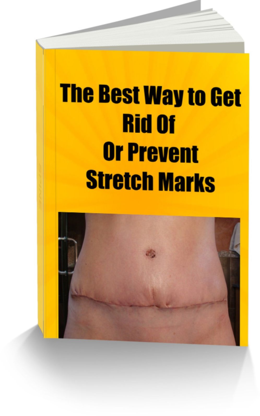 The Best Way to Get Rid Of Or Prevent Stretch Marks