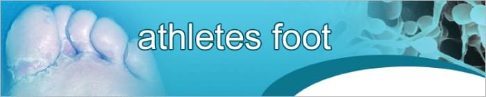 Discovering The Cause Of Athletes Foot
