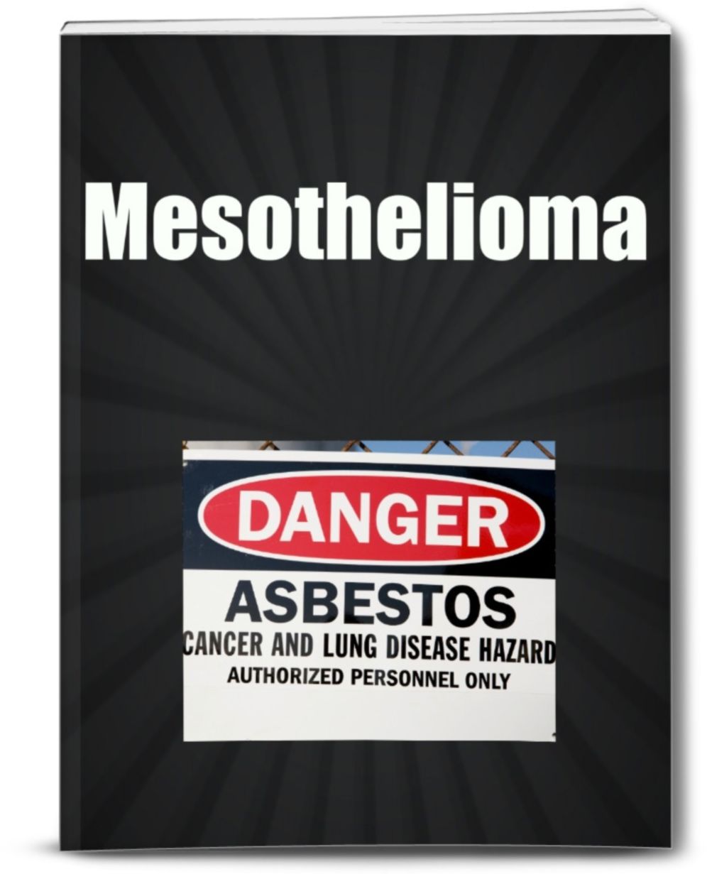 Mesothelioma-Mesothelioma is a Form of Cancer That is Caused by Exposure to Asbestos. In This Disease, Malignant Cells Develop in The Mesothelium, a Protective Lining that Covers Most of the Body's Internal Organs.