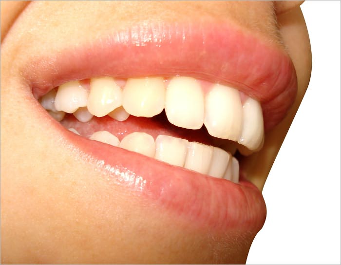 How to Stop Stuttering and Get Your Confidence Back