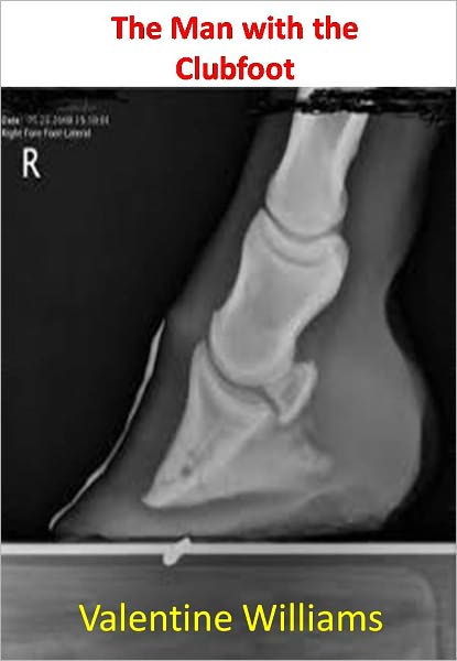 The Man with the Clubfoot w/ Direct link technology( A Espionage Story)