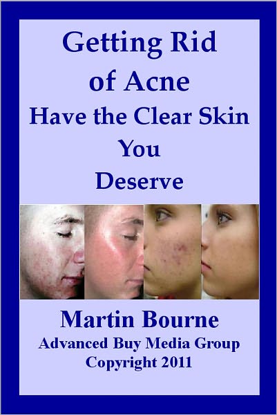 Getting Rid of Acne: Have the Clear Skin You Deserve