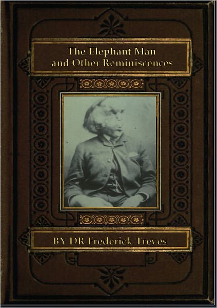 The Elephant Man and Other Reminiscences
