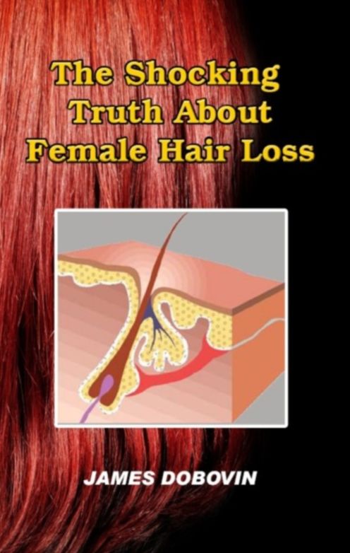 The Shocking Truth About Female Hair Loss