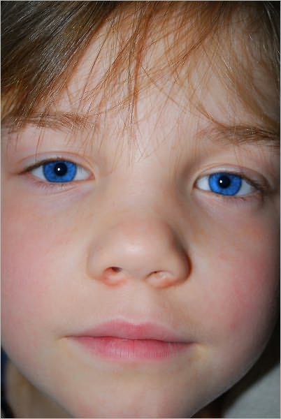 Common Childhood Diseases and How to Prevent also Treat Them
