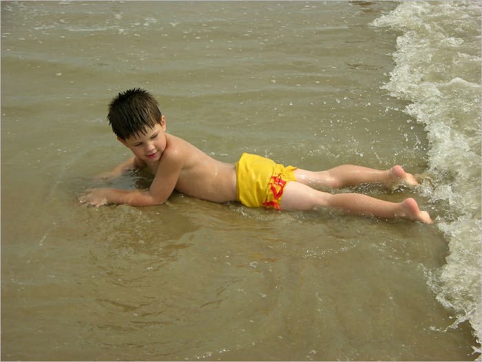How to Deal with Sunburn Fast, Painless and Naturally