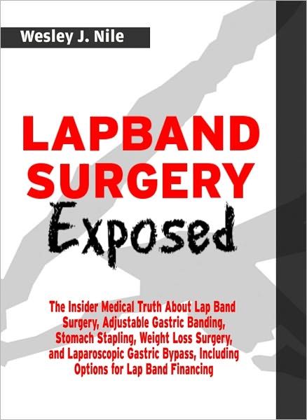Lapband Surgery Exposed: The Insider Medical Truth About Lap Band Surgery, Adjustable Gastric Banding, Stomach Stapling, Weight Loss Surgery, and Laparoscopic Gastric Bypass, Including Options for Lap Band Financing
