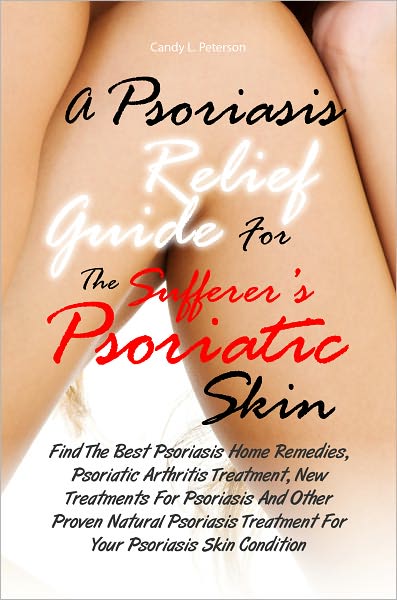 A Psoriasis Relief Guide For The Sufferer’s Psoriatic Skin:Find The Best Psoriasis Home Remedies, Psoriatic Arthritis Treatment, New Treatments For Psoriasis And Other Proven Natural Psoriasis Treatment For Your Psoriasis Skin Condition