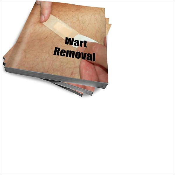 Remove Unwanted And Ugly Warts – A Complete Guide