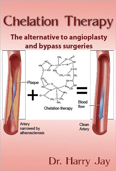 Chelation Therapy