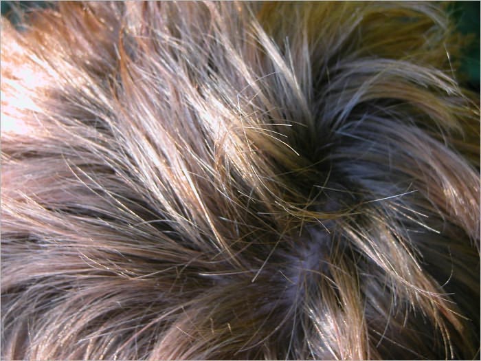 The All-Natural Cure for Dandruff