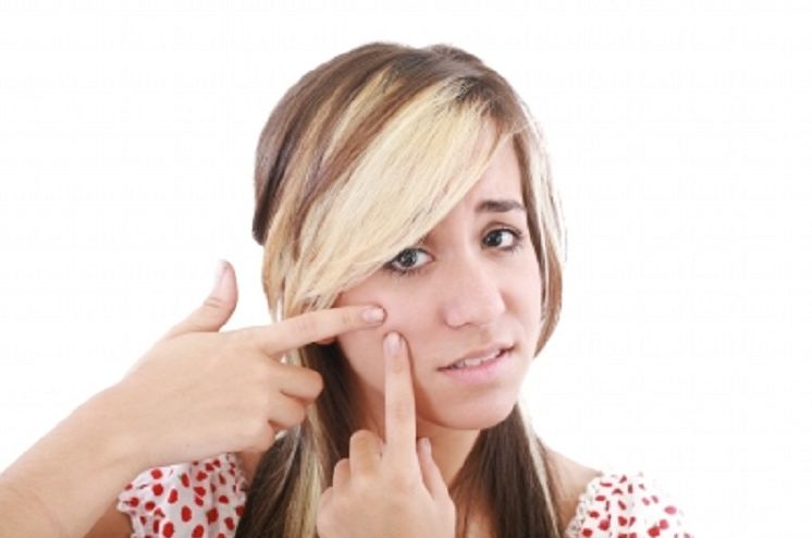 All Natural Acne Remedies....FOR FREE!!