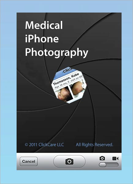 Medical iPhone Photography