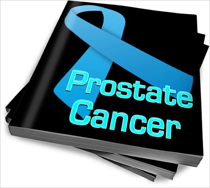 Prostate Cancer - Symptoms And Treatment