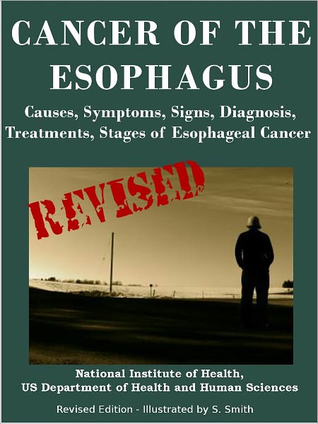 CANCER OF THE ESOPHAGUS: Causes, Symptoms, Signs, Diagnosis, Treatments, Stages of Esophageal Cancer - Revised Edition - Illustrated by S. Smith