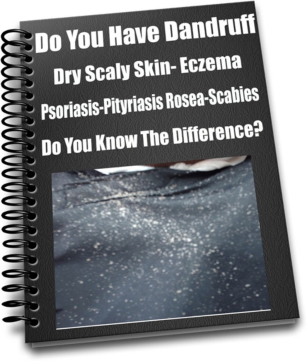Do You Have Dandruff-Dry Scaly Skin- Eczema- Psoriasis-Pityriasis Rosea-Scabies- Do You Know The Difference?