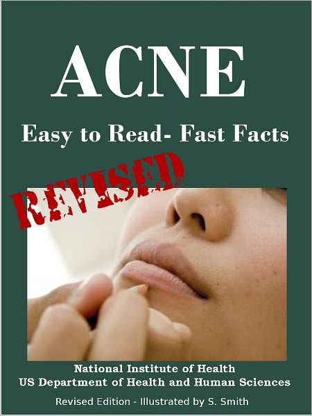 ACNE: Easy to Read- Fast Facts - Edited by S. Smith - Illustrated by S. Smith