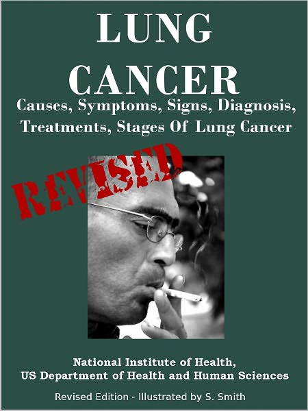 LUNG CANCER: Causes, Symptoms, Signs, Diagnosis, Treatments, Stages Of Lung Cancer - Revised Edition - Illustrated by S. Smith