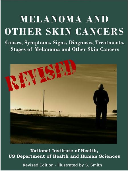 MELANOMA AND OTHER SKIN CANCERS: Causes, Symptoms, Signs, Diagnosis, Treatments, Stages of Melanoma and Other Skin Cancers