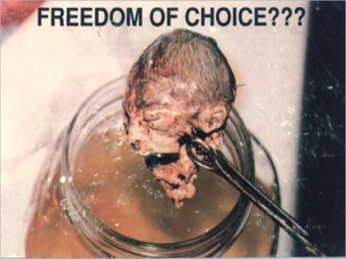 Freedom of Choice?