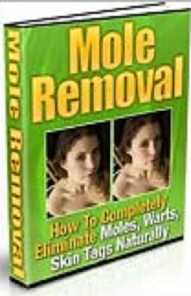 Moles Removal
