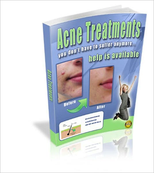 Save You From Frustration & Embarrassment- Acne Treatments - You Don't Have To Suffer Anymore!