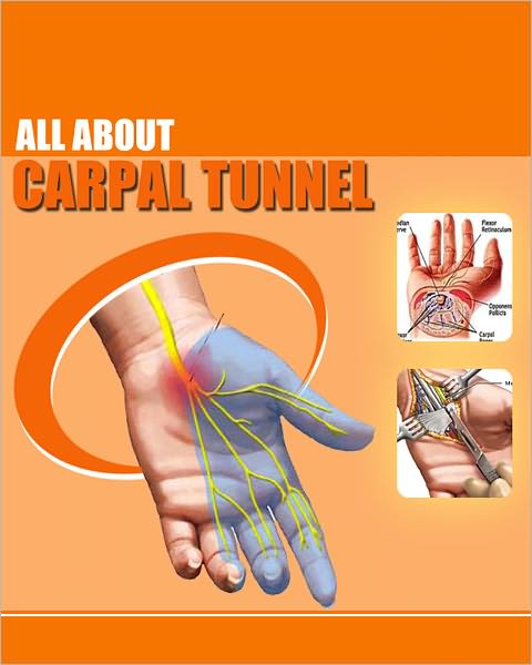 All About Carpel Tunnel