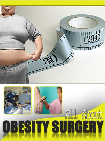 All About Obesity Surgery