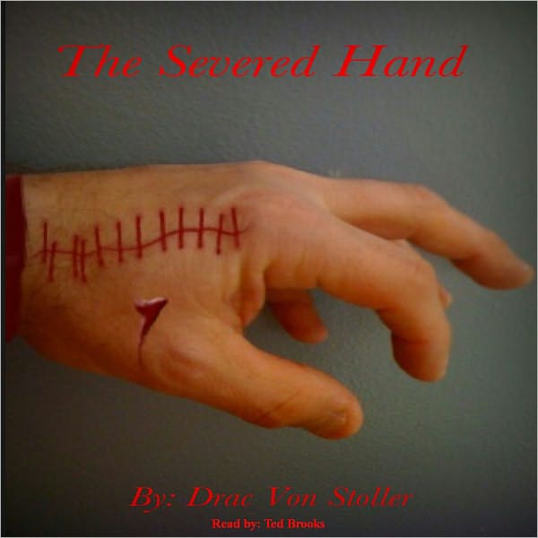 The Severed Hand