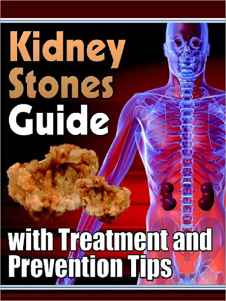 Kidney Stones Guide