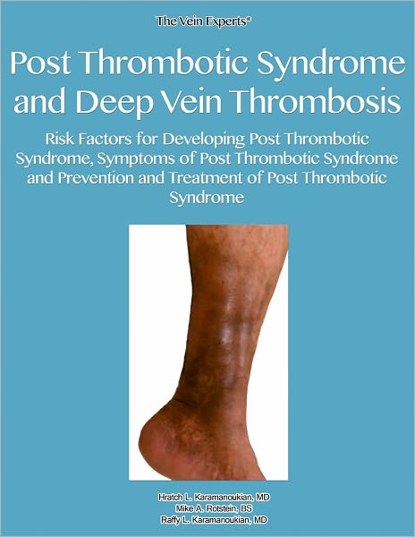 Post Thrombotic Syndrome and Deep Vein Thrombosis