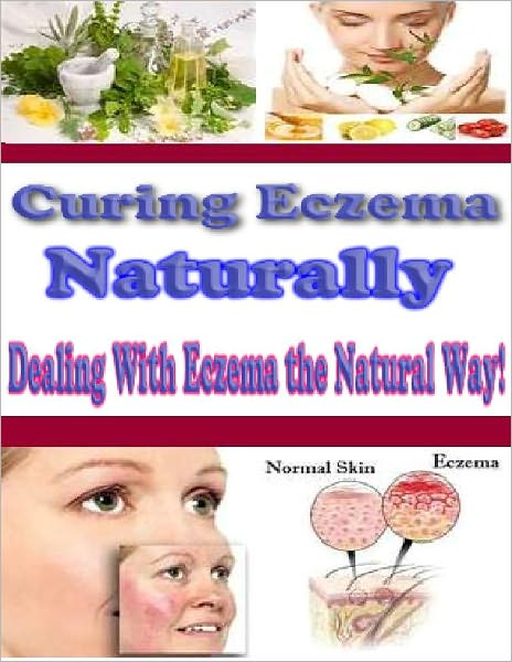 Curing Eczema Naturally