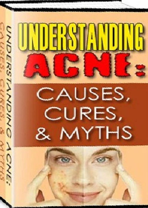 eBook about Understanding Acne - CAUSES, CURES and MYTHS - How to help your child get through acne problems. ..