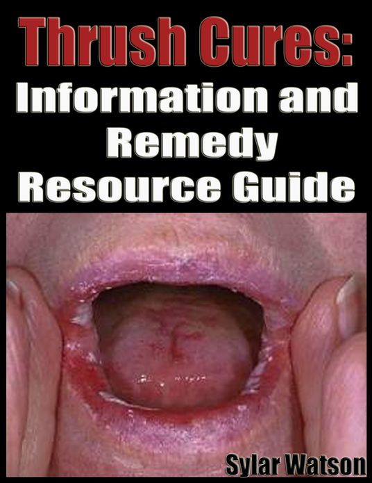 Thrush Cures: Information and Remedy Resource Guide