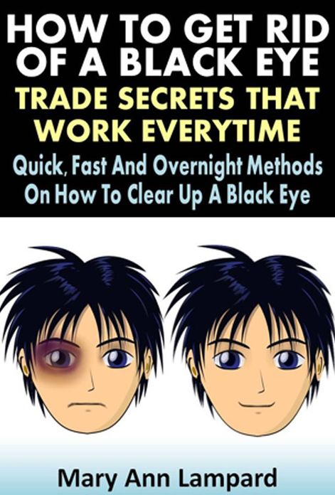 How To Get Rid Of A Black Eye : Trade Secrets That Work Everytime