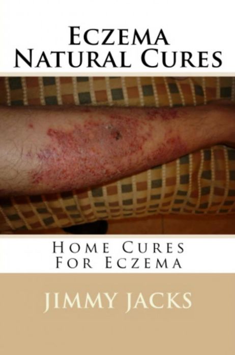 Eczema Natural Cures