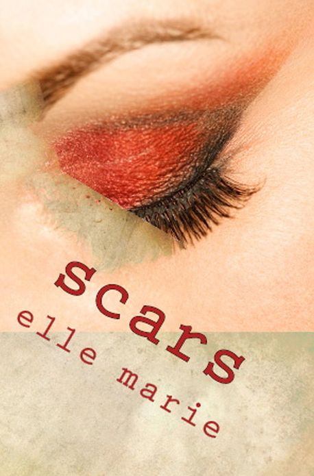 Scars