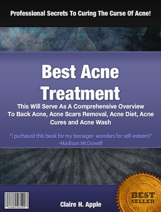 Best Acne Treatment: This Will Serve As A Comprehensive Overview To Wash