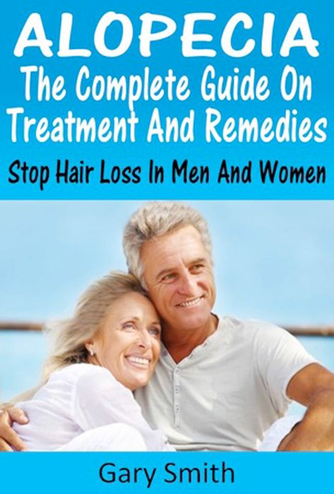 Alopecia: The Complete Guide On Treatments and Remedies Stop Hair Loss In Men and Women