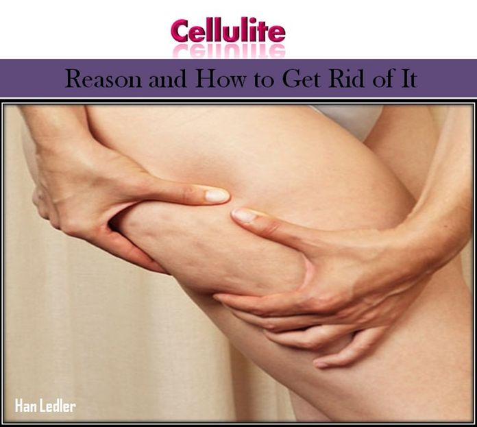 Cellulite: Reason and How to Get Rid of It